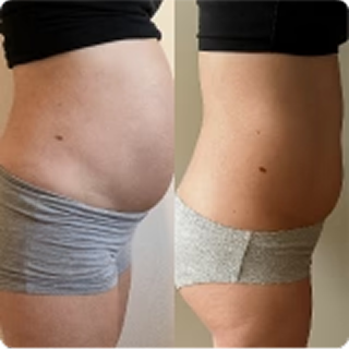 Customer image