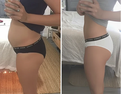 Customer before and after photo